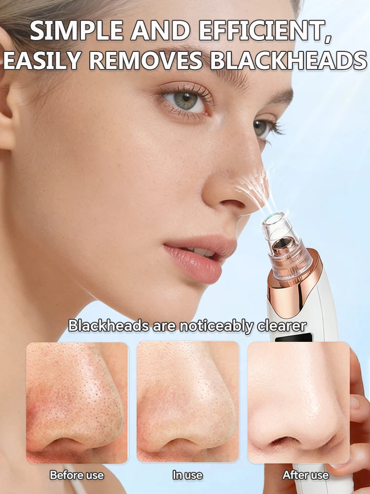 Blackhead Remover pimples and blackheads vacuum pores removal  facial skin cleansing device For Deep cleaning home