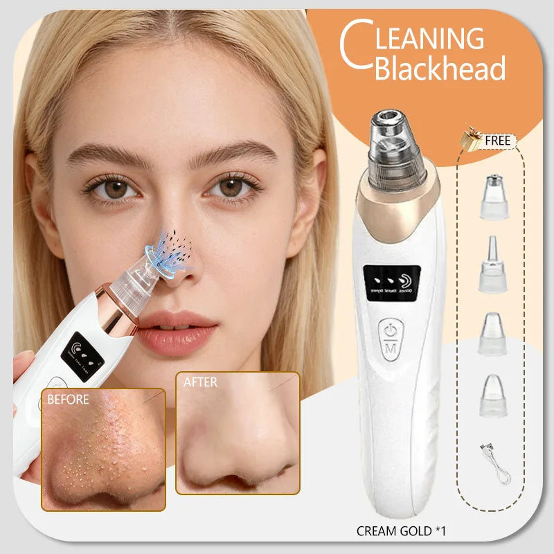 Blackhead Remover pimples and blackheads vacuum pores removal  facial skin cleansing device For Deep cleaning home