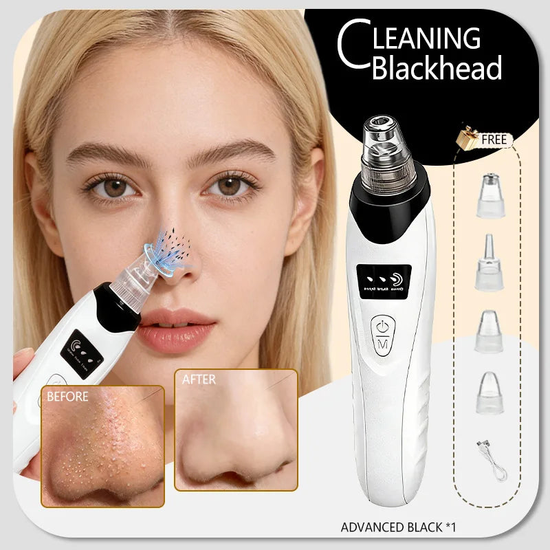 Blackhead Remover pimples and blackheads vacuum pores removal  facial skin cleansing device For Deep cleaning home