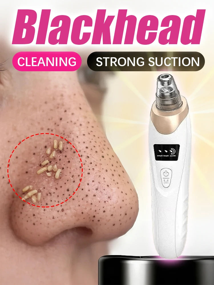 Blackhead Remover pimples and blackheads vacuum pores removal  facial skin cleansing device For Deep cleaning home